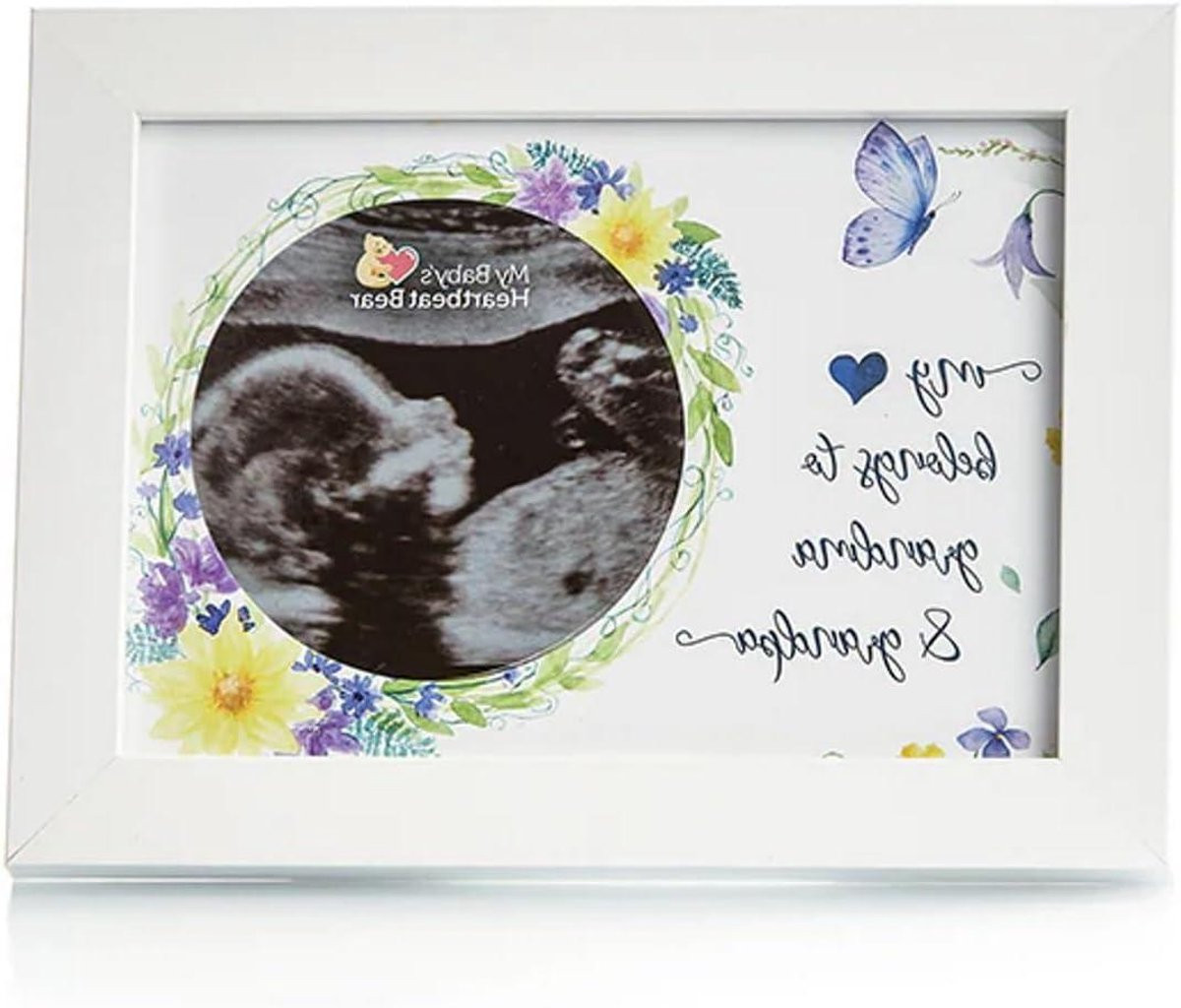 Wit Houten Fotolijst met Ronde Uitsparing voor Echografie Foto's, 5x7 inch