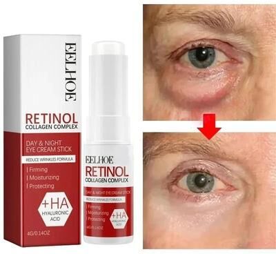 Rare Purchases Instant Eye Bag Remove Eye Cream, Korean Beauty Eye Care Fade Dark Circles Puffiness, Lift Brighten And Reduce Fine Line Instant Eye Bag Remove Eye Cream, Korean Beauty Eye Care Fade Dark Circles Puffiness, Lift Brighten And Reduce Fine Lin