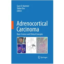 Adrenocortical Carcinoma, Fachbücher von Tobias Else, Gary D. Hammer