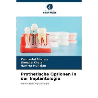 Prothetische Optionen in der Implantologie, Taschenbuch von Kundanlal sharma,Jitendra Khetan,Namrta Mahajan, Verlag Unser Wissen, 978-620-2-42139-3