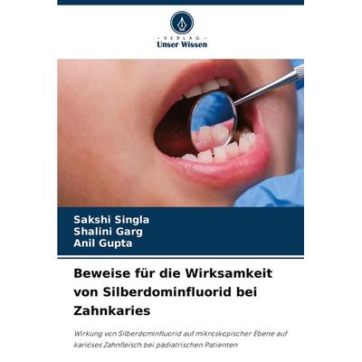 Beweise für die Wirksamkeit von Silberdominfluorid bei Zahnkaries, Taschenbuch von Sakshi Singla,Shalini Garg,Anil Gupta, Verlag Unser Wissen,