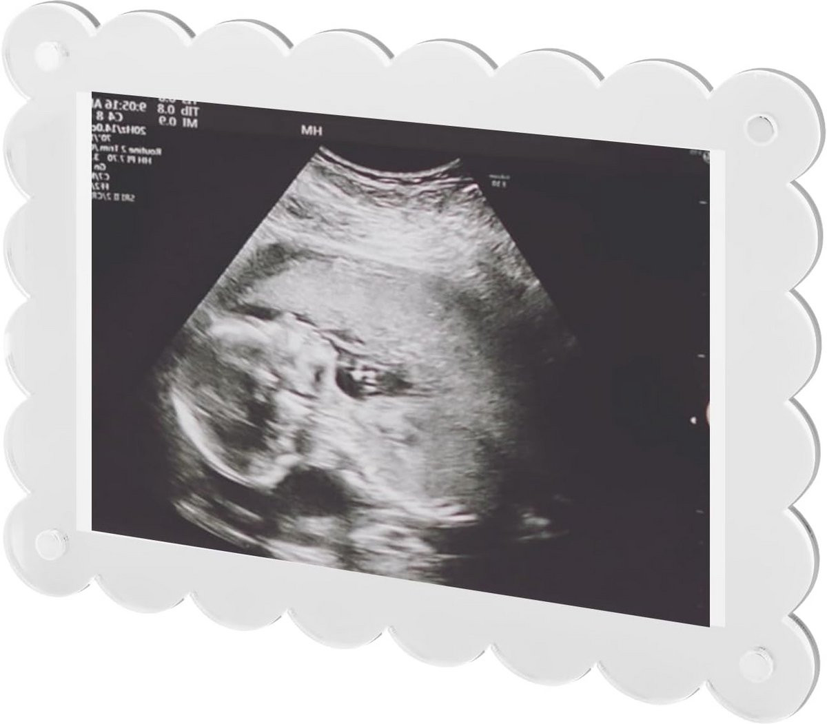 Gegolfd Acryl Fotolijst Magnetisch 18x13 cm - Ideaal voor Zwangerschapsaankondiging en Gender Reveal Cadeau