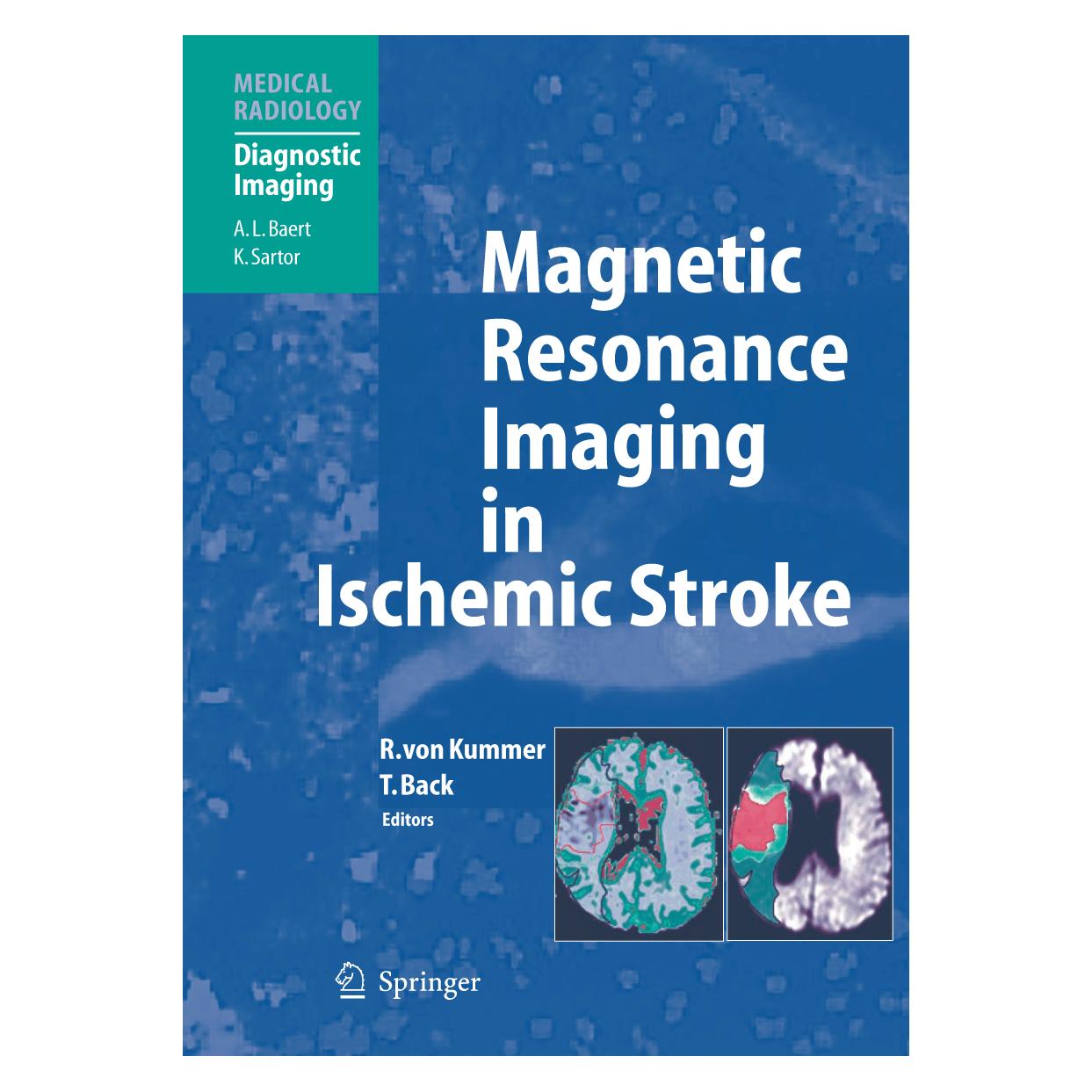 Springer Magnetic Resonance Imaging in Ischemic Stroke (Englisch, Softcover, Rüdiger von Kummer, Tobias Back) (55374862)