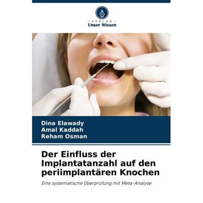 Der Einfluss der Implantatanzahl auf den periimplantären Knochen, Taschenbuch von Dina Elawady,Amal Kaddah,Reham Osman, Verlag Unser Wissen,