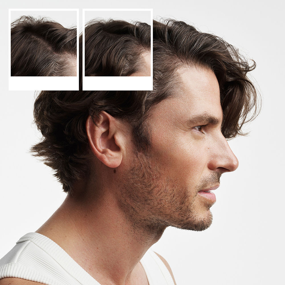 Nioxin System 2 - Kit - Traitement pour cheveux naturels avec affaiblissement avancé 3 unités