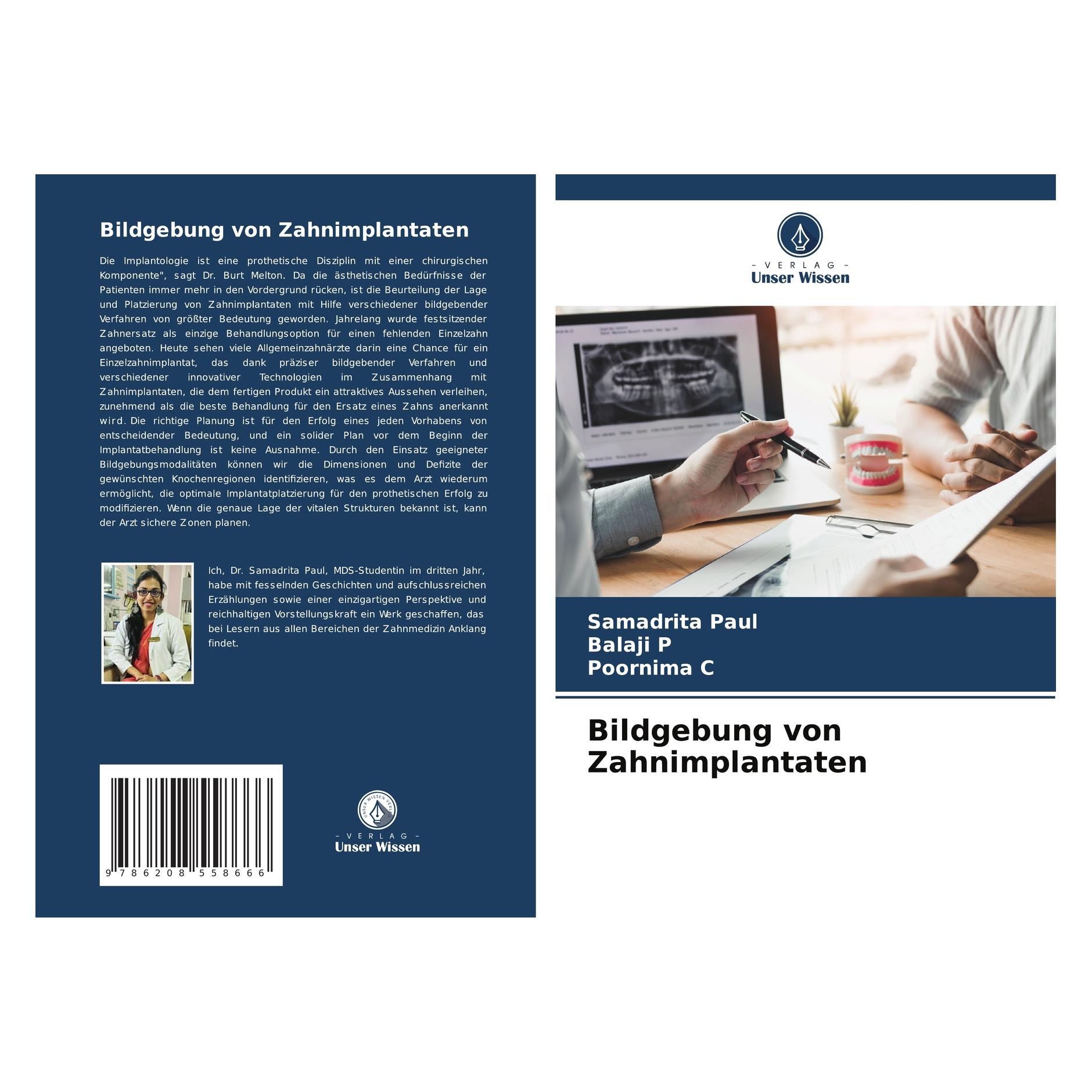 Bod Bildgebung von Zahnimplantaten (57195288)