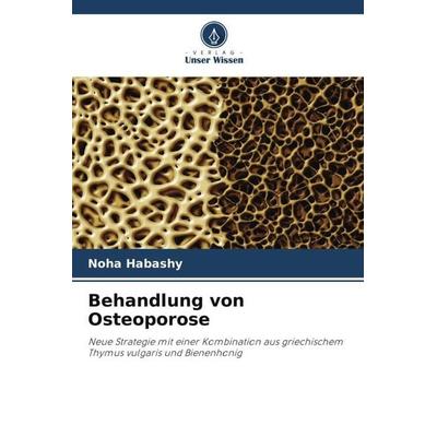 Behandlung von Osteoporose, Taschenbuch von Noha Habashy, Verlag Unser Wissen, 978-620-4-91855-6