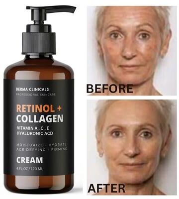 Retailers Go Retinol + Collagen, Hyaluronic Acid, Vitamin C AntiAging Wrinkle Serum Cream 4oz Retinol + Collagen, Hyaluronic Acid, Vitamin C AntiAging Wrinkle Serum Cream 4oz