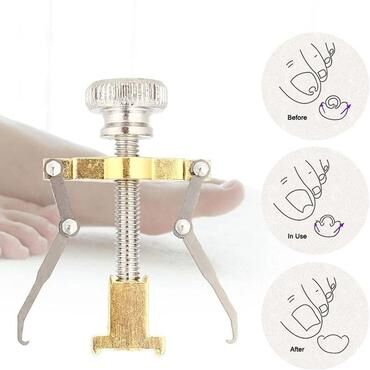 Multicon Wholesale Hub Ingrown Toenail Correction Lifter Tool Straightener & Fixer For Toe Nail Relief Ingrown Toenail Correction Lifter Tool Straightener & Fixer For Toe Nail Relief