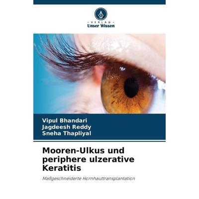 Mooren-Ulkus und periphere ulzerative Keratitis, Taschenbuch von Vipul Bhandari,Jagdeesh Reddy,Sneha Thapliyal, Verlag Unser Wissen, 978-620-9-21547-6
