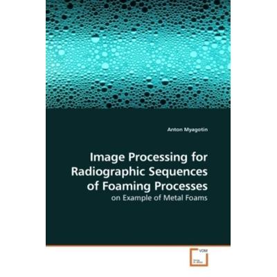Myagotin, A: Image Processing for Radiographic Sequences of, Taschenbuch von Anton Myagotin, VDM, 978-3-639-20807-8