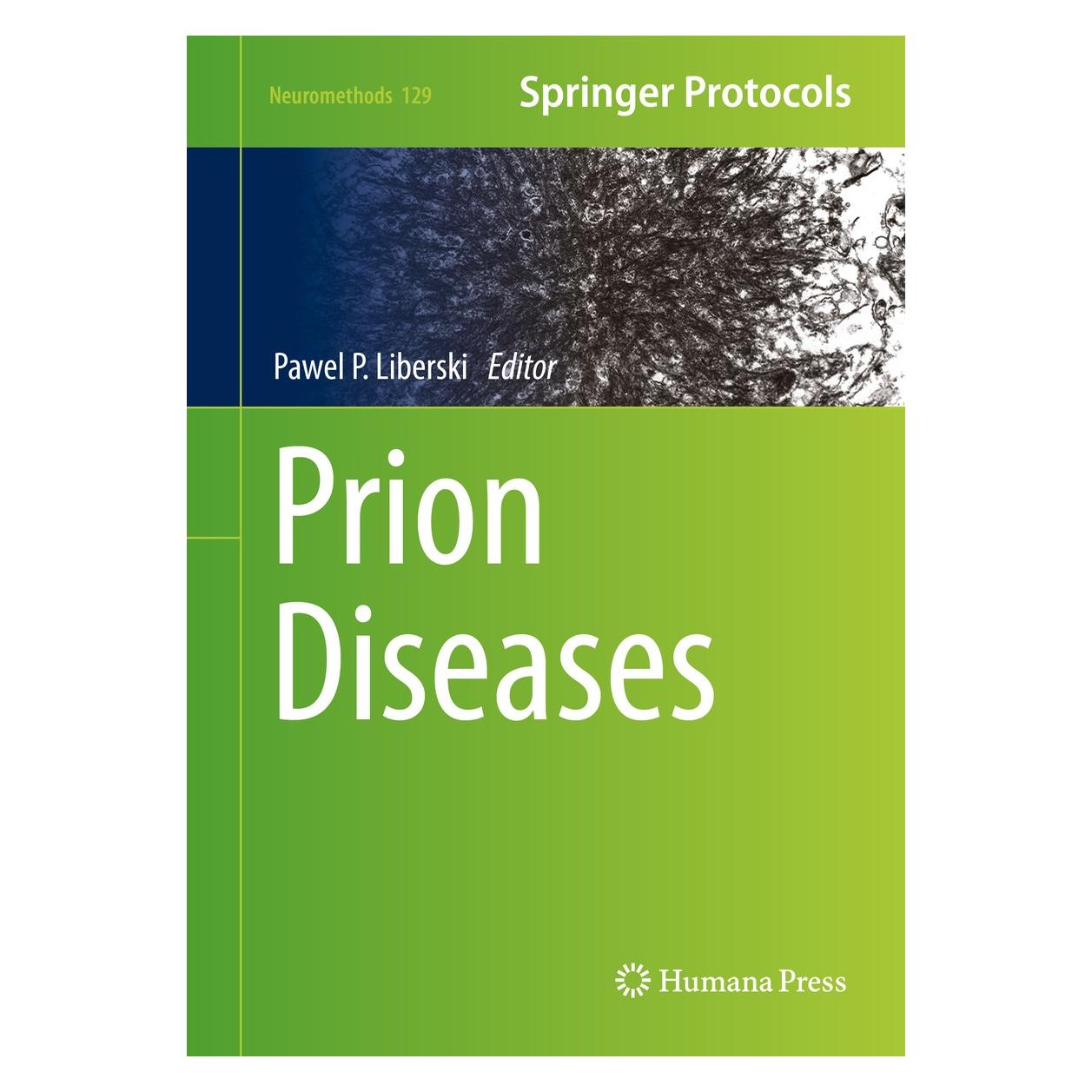 Springer Prion Diseases (Englisch, Hardcover, Pawel P. Liberski) (9781493972098)
