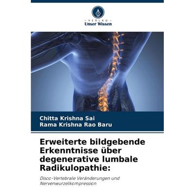 Erweiterte bildgebende Erkenntnisse über degenerative lumbale Radikulopathie:, Taschenbuch von Chitta Krishna Sai,Rama Krishna Rao Baru, Verlag Unser