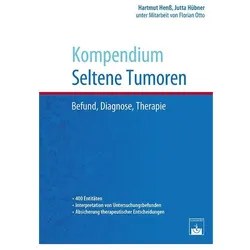Kompendium Seltene Tumoren, Fachbücher von Hartmut Henss, Jutta Hübner