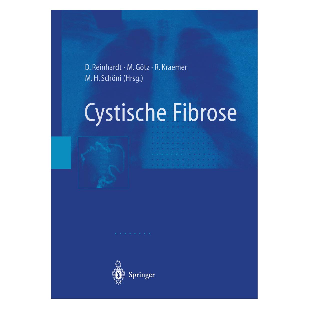 Springer Cystische Fibrose (Deutsch, Softcover, D. Reinhardt, M. Götz, M. Schöni, R. Kraemer) (6902471)