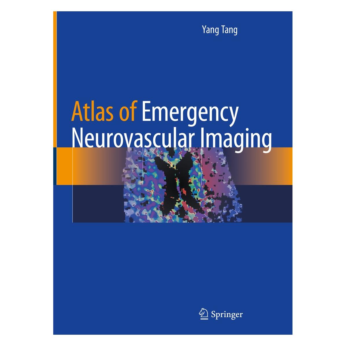 Springer Tang:Atlas of Emergency Neurovascular I (Englisch, Hardcover, Yang Tang) (9783030436537)