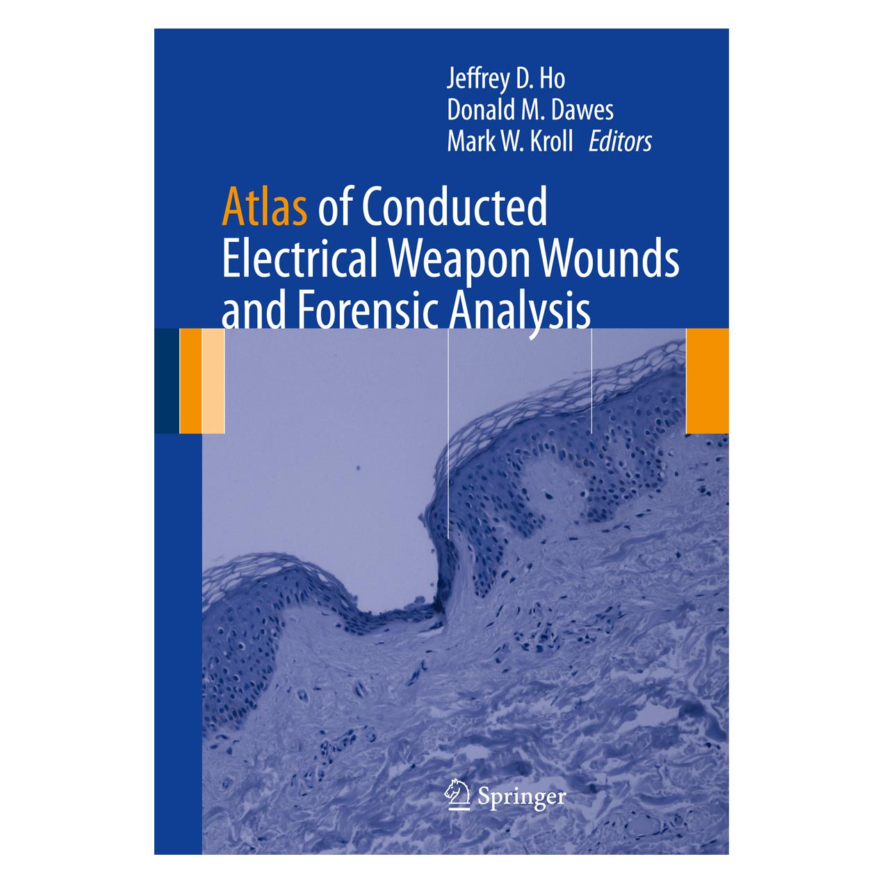 Springer Atlas of Conducted Electrical Weapon Wounds and Forensic Analysis (Englisch, Hardcover, Donald M. Dawes, Jeffrey D. Ho, Mark W. Kroll) (9781461435426)