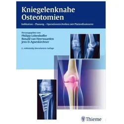 Kniegelenknahe Osteotomien, Fachbücher von Philipp Lobenhoffer, Jens Agneskirchner, Ronald van Heerwaarden