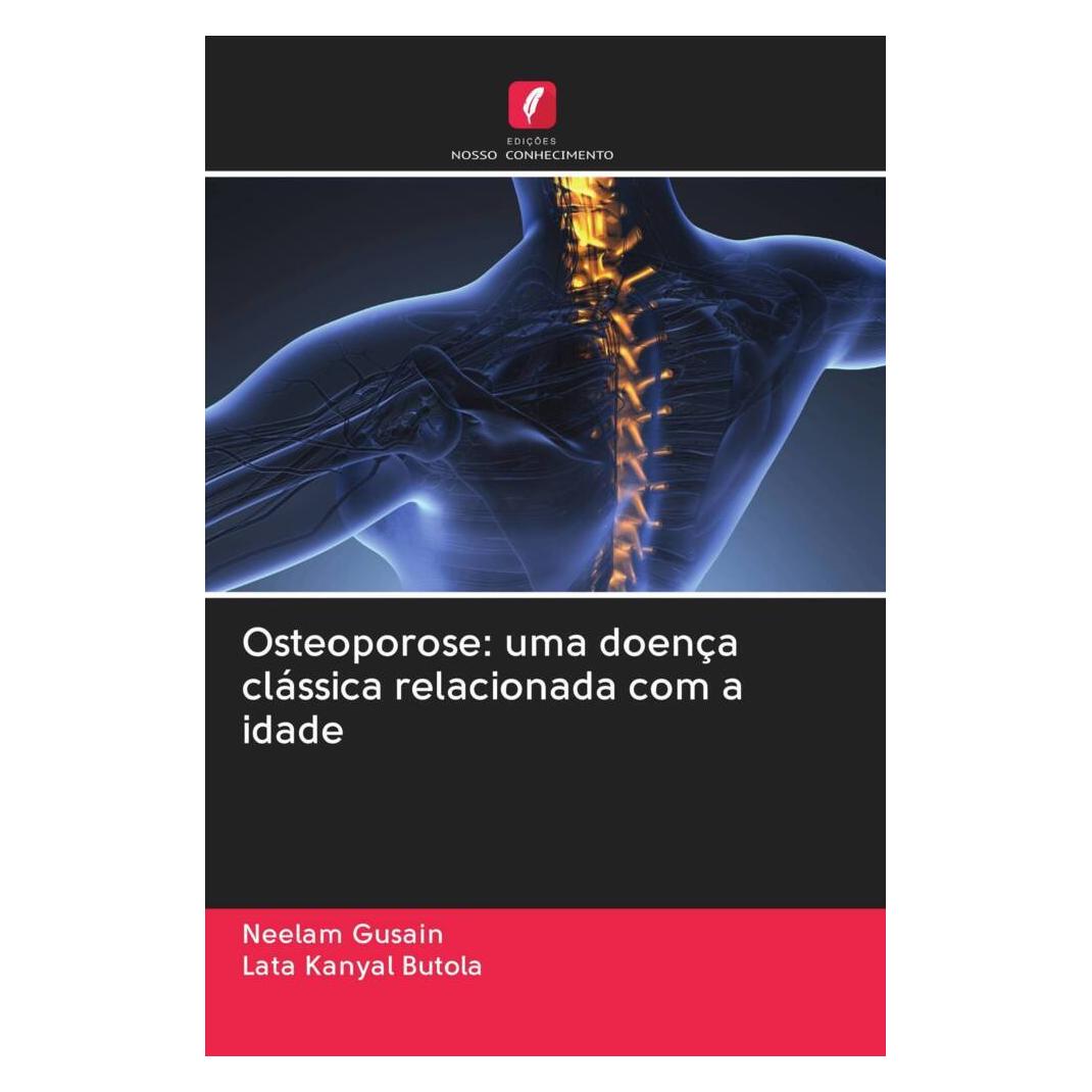 Edicoes Nosso Conhecimento Osteoporose: uma doença clássica relacionada com a idade (Portugiesisch, Softcover, Lata Kanyal Butola, Neelam Gusain) (56167889)