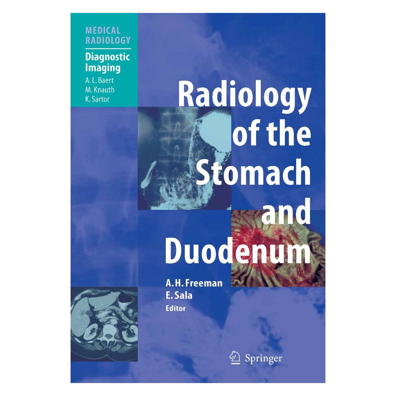 Springer Radiology of the stomach and Duodenum (Englisch, Alan H. Freeman, Evis Sala, 2008) (9783540424628)