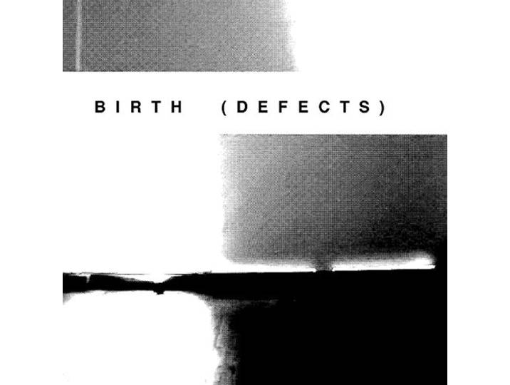 Birth (Defects)