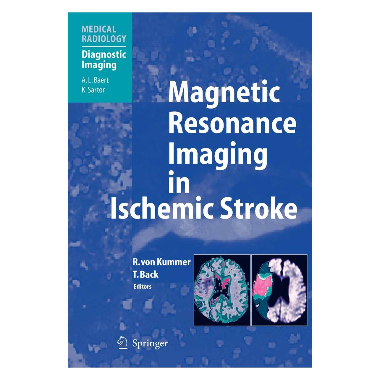 Springer Magnetic Resonance Imaging in Ischemic (Englisch, Hardcover, Rüdiger von Kummer, Tobias Back) (9783540008613)