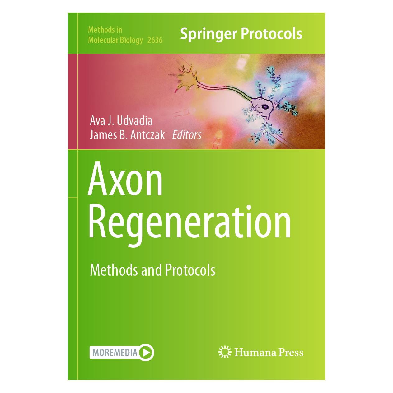 Springer Axon Regeneration (Englisch, Softcover, Ava J. Udvadia, James B. Antczak) (57014701)