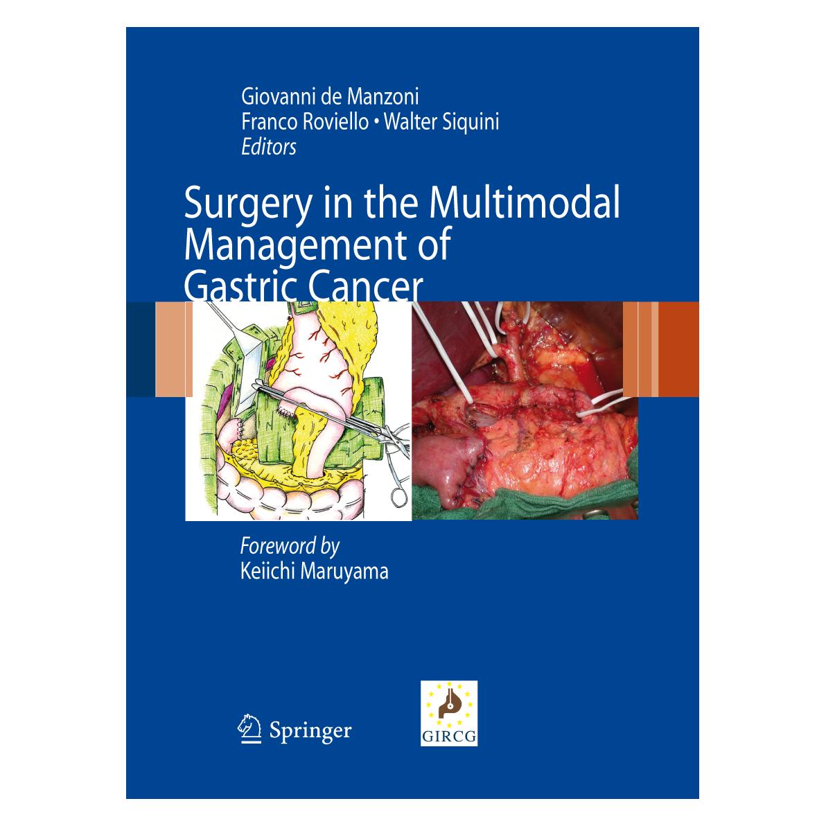 Springer Surgery in the Multimodal Management of Gastric Cancer (Englisch, Hardcover) (9788847023178)
