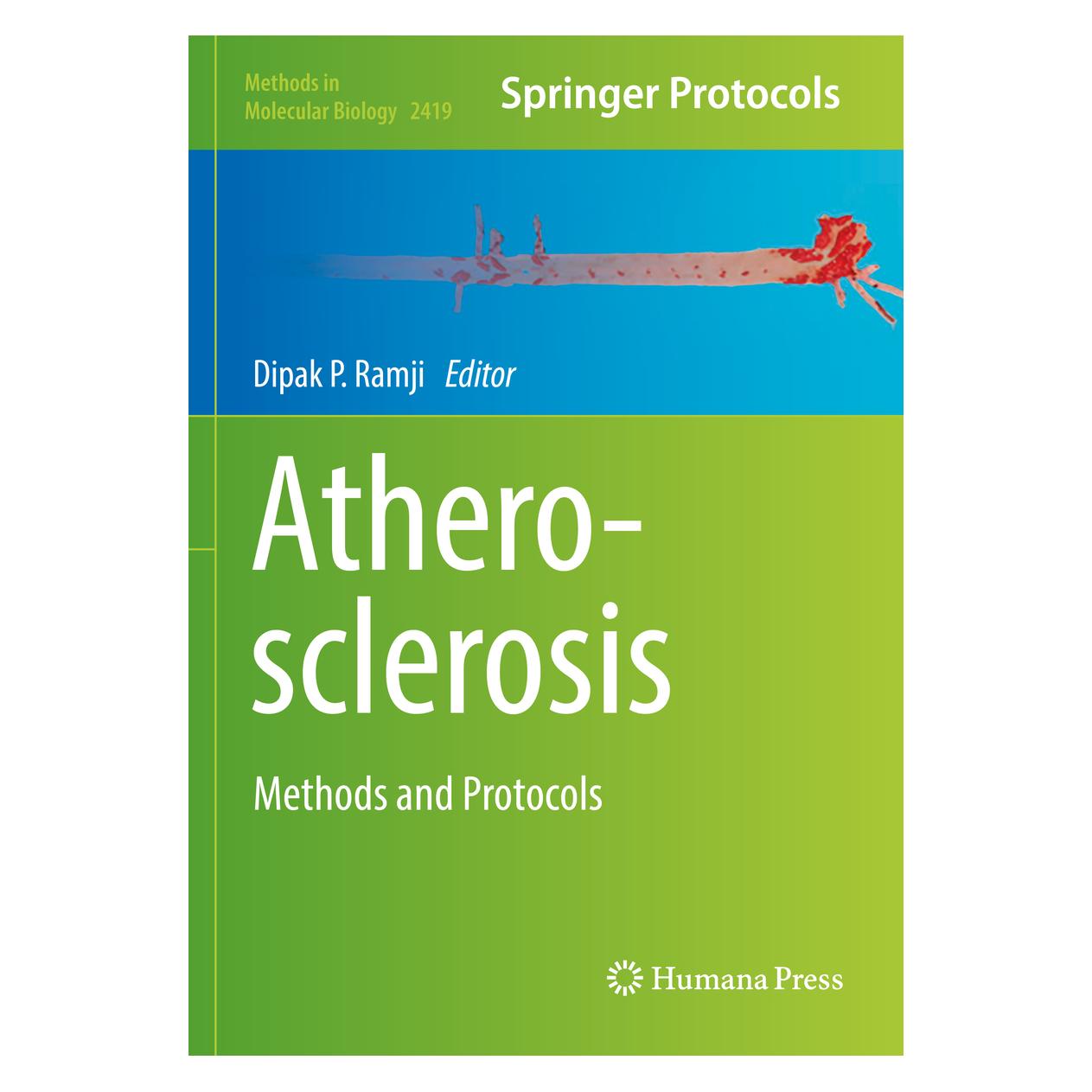 Springer Atherosclerosis (Englisch, Softcover) (56935828)