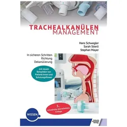 Trachealkanülenmanagement, Fachbücher von Sarah Stierli, Stephan Mayer, Hans Schwegler