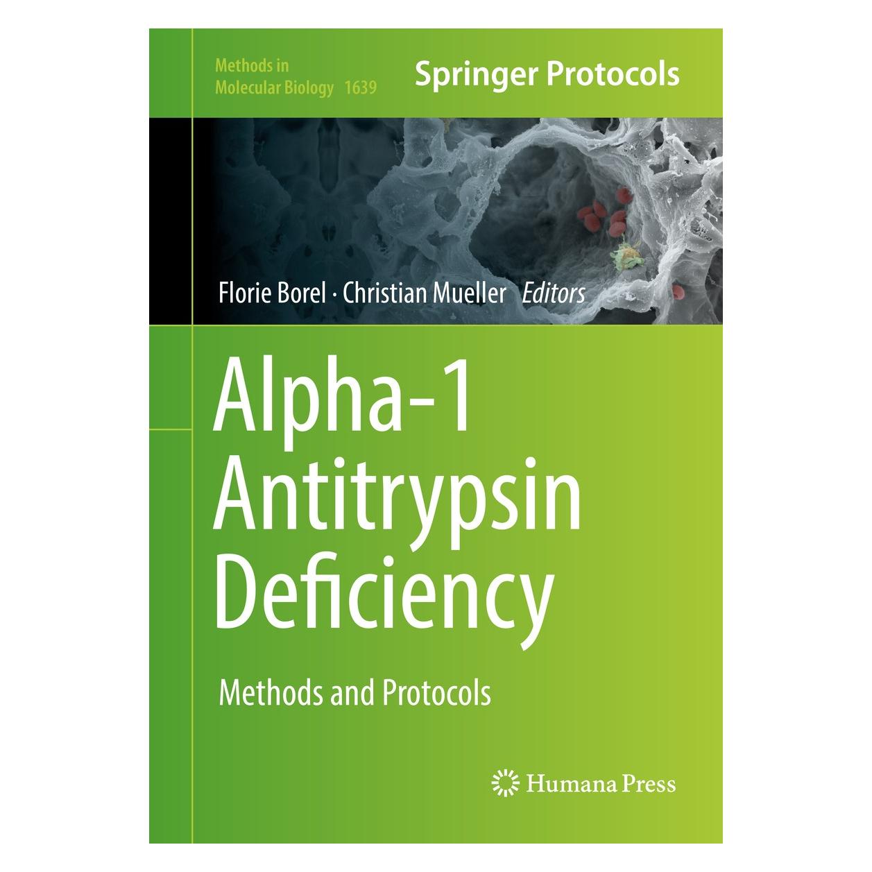Springer Alpha-1 Antitrypsin Deficiency (Englisch, Hardcover, Christian Mueller, Florie Borel) (9781493971619)