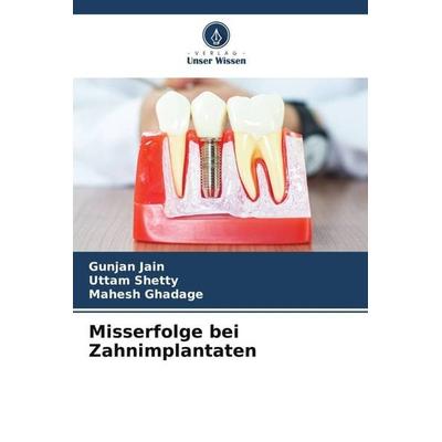 Misserfolge bei Zahnimplantaten, Taschenbuch von Gunjan Jain,Uttam Shetty,Mahesh Ghadage, Verlag Unser Wissen, 978-620-5-06567-9