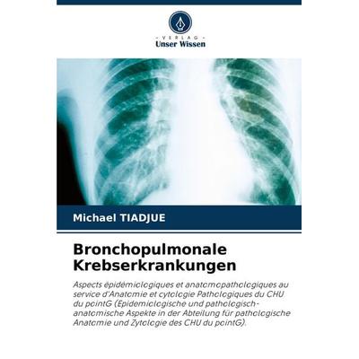Bronchopulmonale Krebserkrankungen, Taschenbuch von Michael Tiadjue, Verlag Unser Wissen, 978-620-7-12500-5
