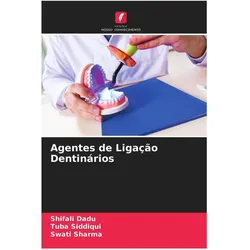 Agentes de Ligação Dentinários, Ratgeber von Tuba Siddiqui, Swati Sharma, Shifali Dadu