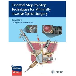 Essential Step-by-Step Techniques for Minimally Invasive Spinal Surgery, Fachbücher von Roger Hartl, Rodrigo Navarro-Ramirez