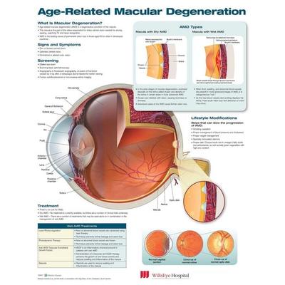 Age-Related Macular Degeneration Anatomical Chart, von , Ingram Publishers Services, 978-1-4963-8130-9