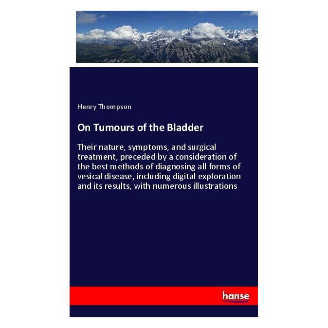 Hansebooks On Tumours of the Bladder (Englisch, Softcover, Henry Thompson) (55972789)
