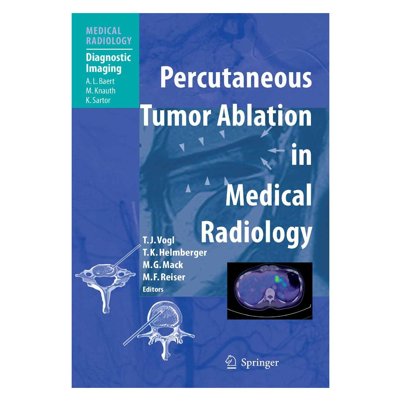 Springer Percutaneous Tumor Ablation in Medical (Englisch, Hardcover, Martin G. Mack, Maximilian F. Reiser, Thomas J. Vogl, Thomas K. Helmberger) (9783540225188)