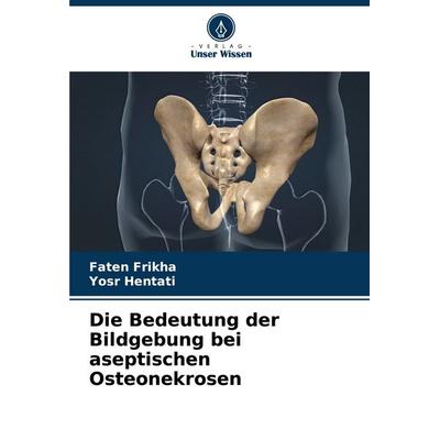 Die Bedeutung der Bildgebung bei aseptischen Osteonekrosen, Taschenbuch von Faten Frikha,Yosr Hentati, Verlag Unser Wissen, 978-620-2-32531-8