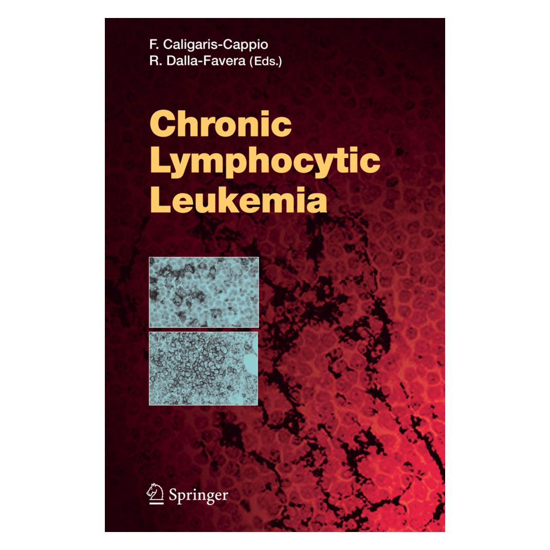 Springer Chronic Lymphocytic Leukemia (Englisch, Softcover, Federico Caligaris-Cappio, Riccardo Dalla Favera) (55374252)