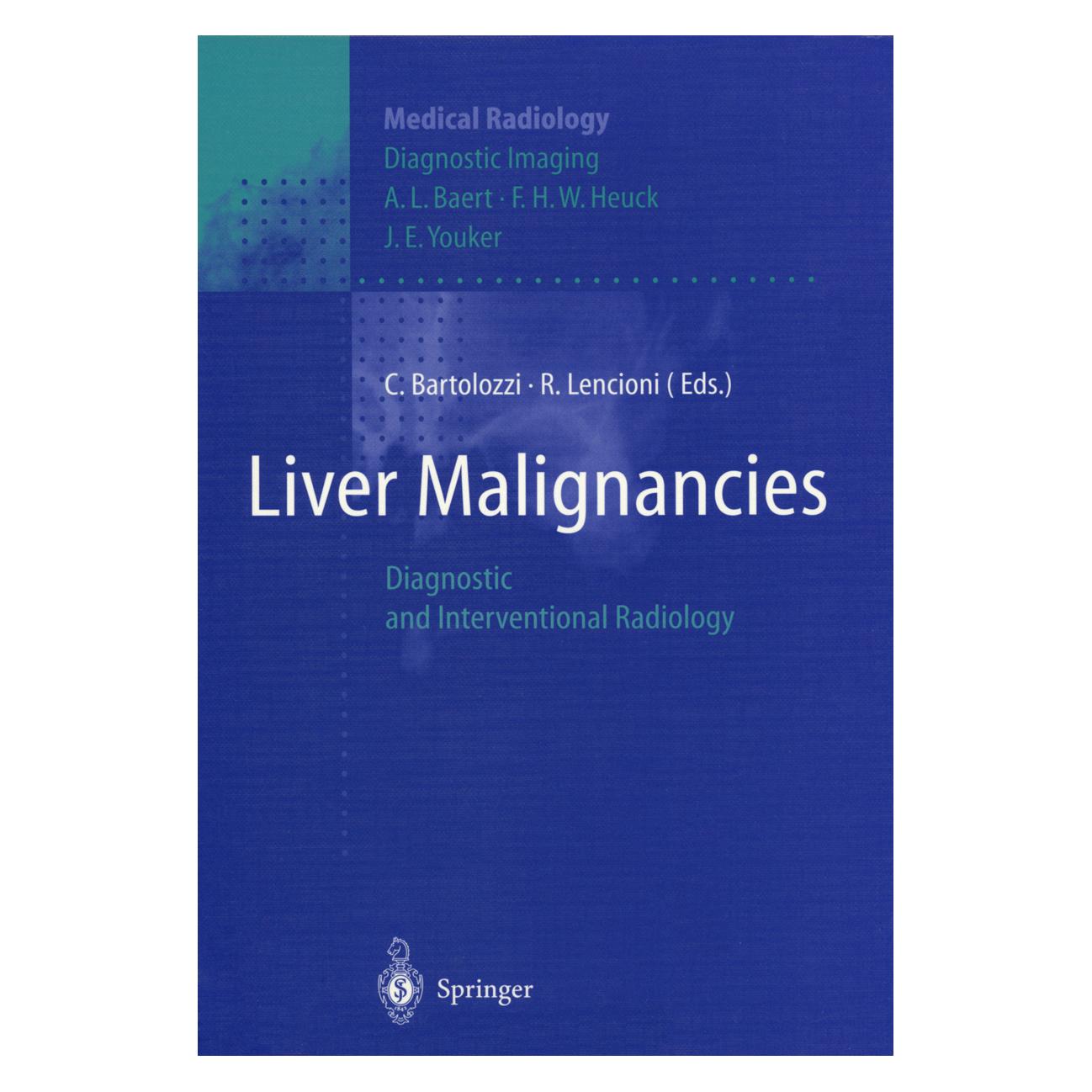 Springer Liver Malignancies (Englisch, Softcover, C. Bartolozzi, R. Lencioni) (55531570)