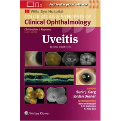 Uveitis, Fachbücher von Sunir J. Garg
