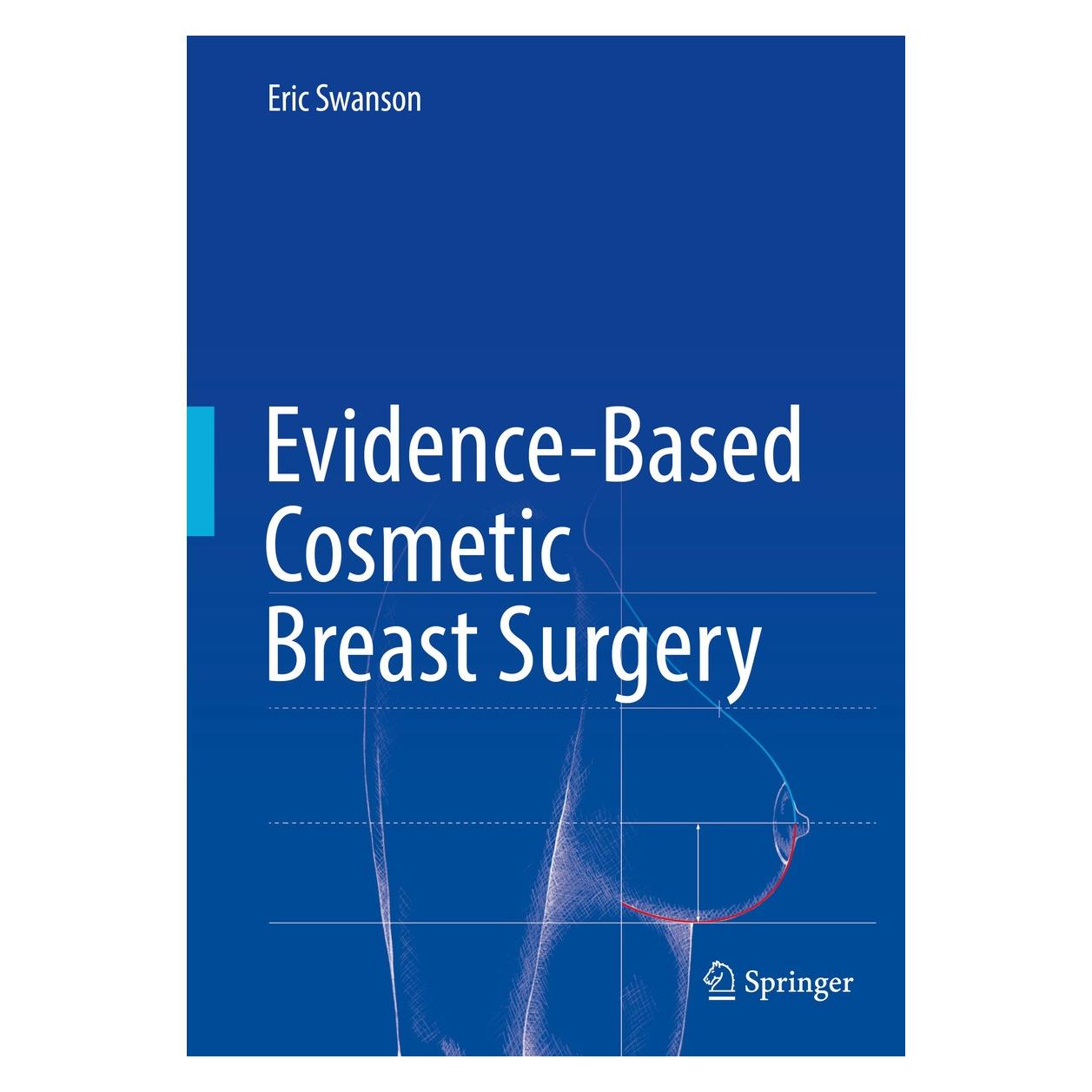Springer Swanson:Evidence-Based Cosmetic Breast (Englisch, Hardcover, Eric Swanson) (9783319539577)