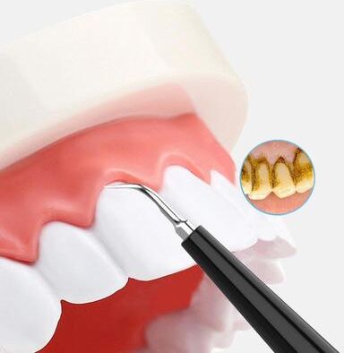 Inspired Deals Electric Teeth Cleaner Tartar Remover Tool For Home Dental Care black