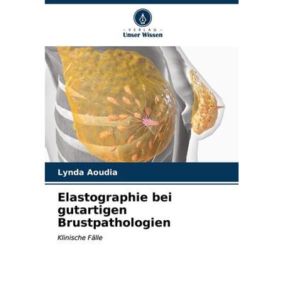 Elastographie bei gutartigen Brustpathologien, Taschenbuch von Lynda Aoudia, Verlag Unser Wissen, 978-620-6-55292-5