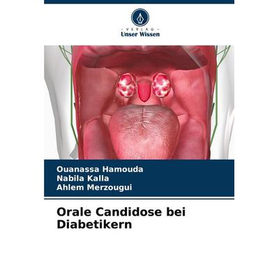 Orale Candidose bei Diabetikern, Taschenbuch von Ouanassa Hamouda,Nabila Kalla,Ahlem Merzougui, Verlag Unser Wissen, 978-620-8-50919-4