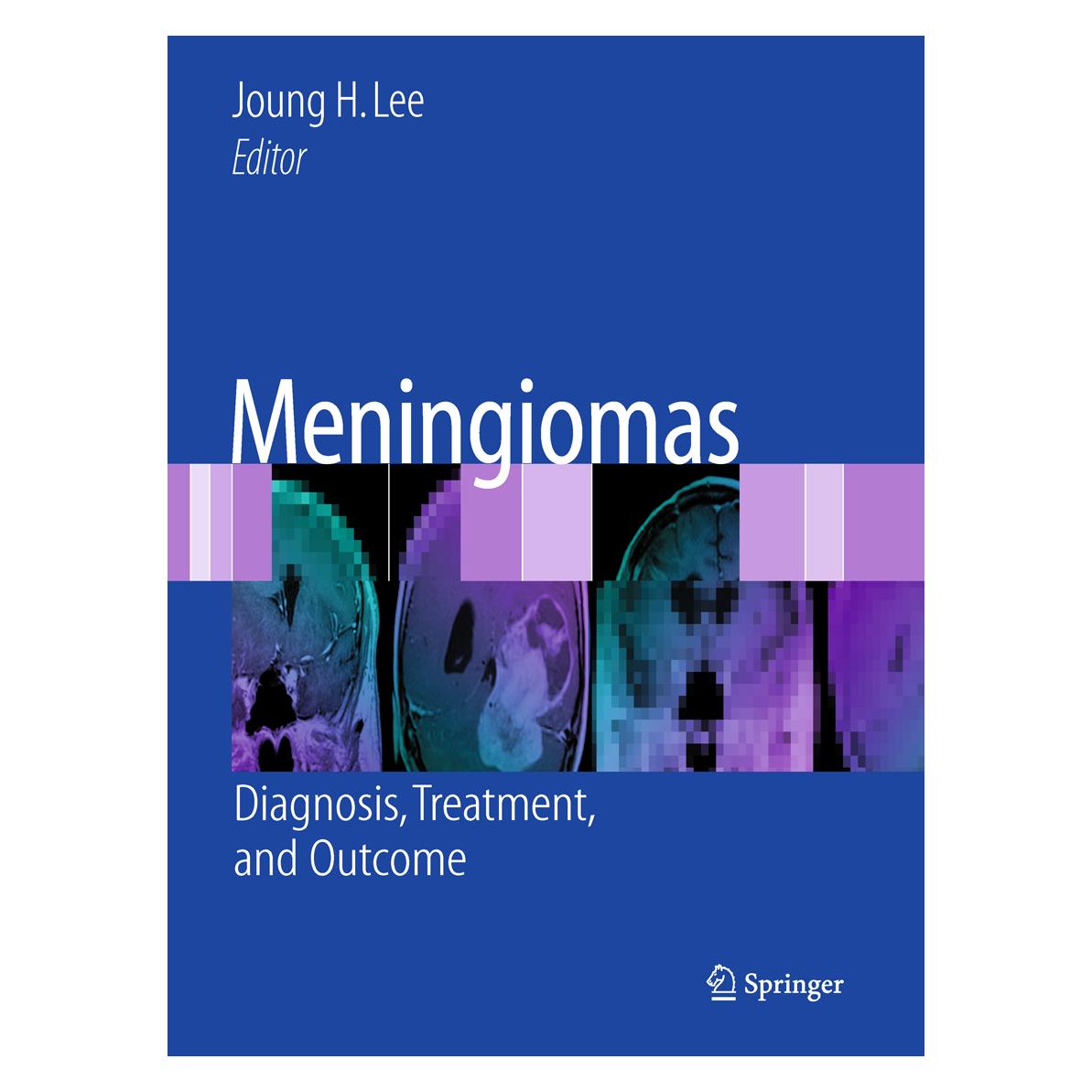 Springer Meningiomas (Englisch, Softcover, Joung H. Lee) (55208747)