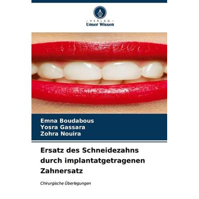 Ersatz des Schneidezahns durch implantatgetragenen Zahnersatz, Taschenbuch von Emna Boudabous,Yosra Gassara,Zohra Nouira, Verlag Unser Wissen,