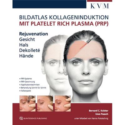 Bildatlas Kollageninduktion mit Platelet Rich Plasma (PRP), Gebundene Ausgabe von Uwe Paasch,Bernard C. Kolster, KVM - Der Medizinverlag,