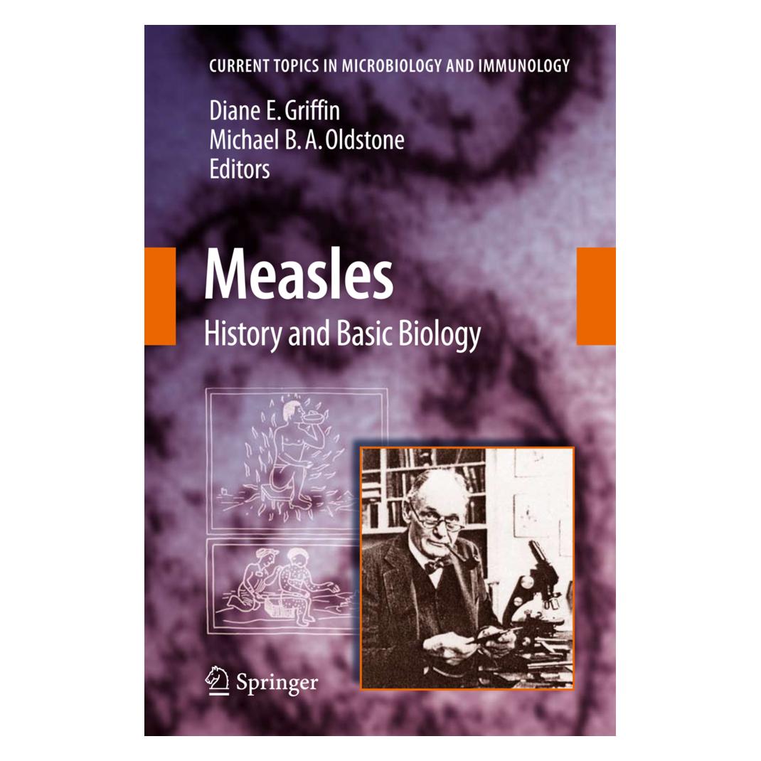 Springer Measles (Englisch, Softcover, Diane E. Griffin, Michael B. A. Oldstone) (55387821)